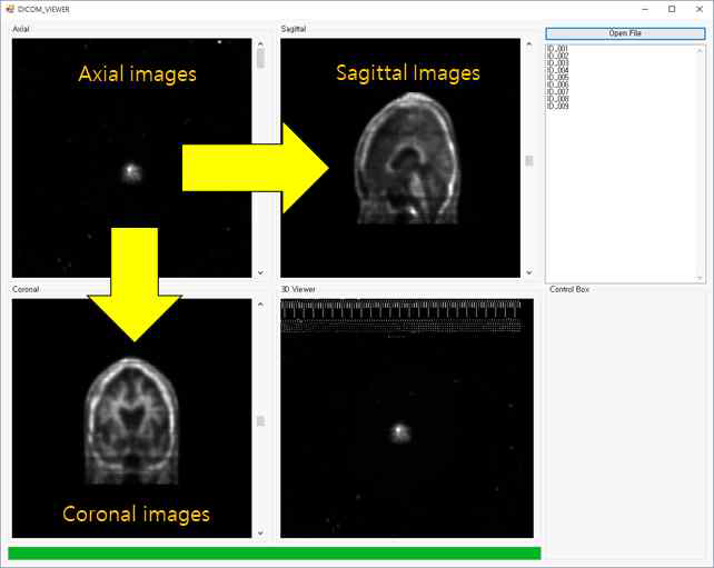 Three Orthogonal Display of DICOM images