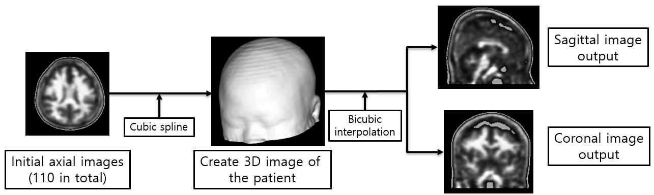 Flowchart of the method for creating sagittal and coronal axes using axial image