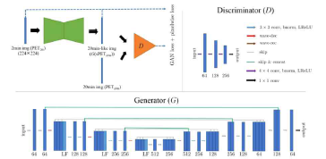 The schematic diagram of the adversarial network used in this study (top left). In this proposed network, the discriminator (top right) and the generator (bottom row) are shown, and the generator is constructed using the deep convolutional framelets. The numbers below the rectangular boxes indicate the number of filters