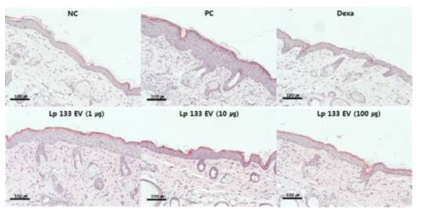 황색포도상구균 (S. aureus) 유래소포에 의한 아토피피부염 마우스모델에서 유산균 유래소포 경구투여 시 조직학적인 변화