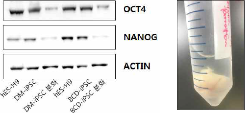 각 역분화 줄기세포에 대한 전분화능 특이 단백질 확인 (왼쪽-Western blot), CD-iPSC derived teratoma (오른쪽)