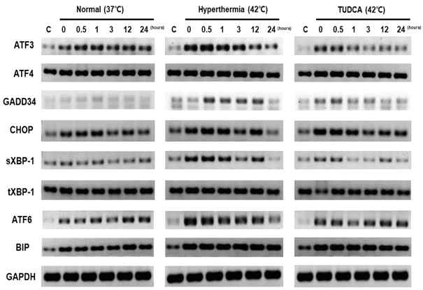 ER-stress 저해제 (TUDCA) 처리에 의한 UPR 유전자 감소