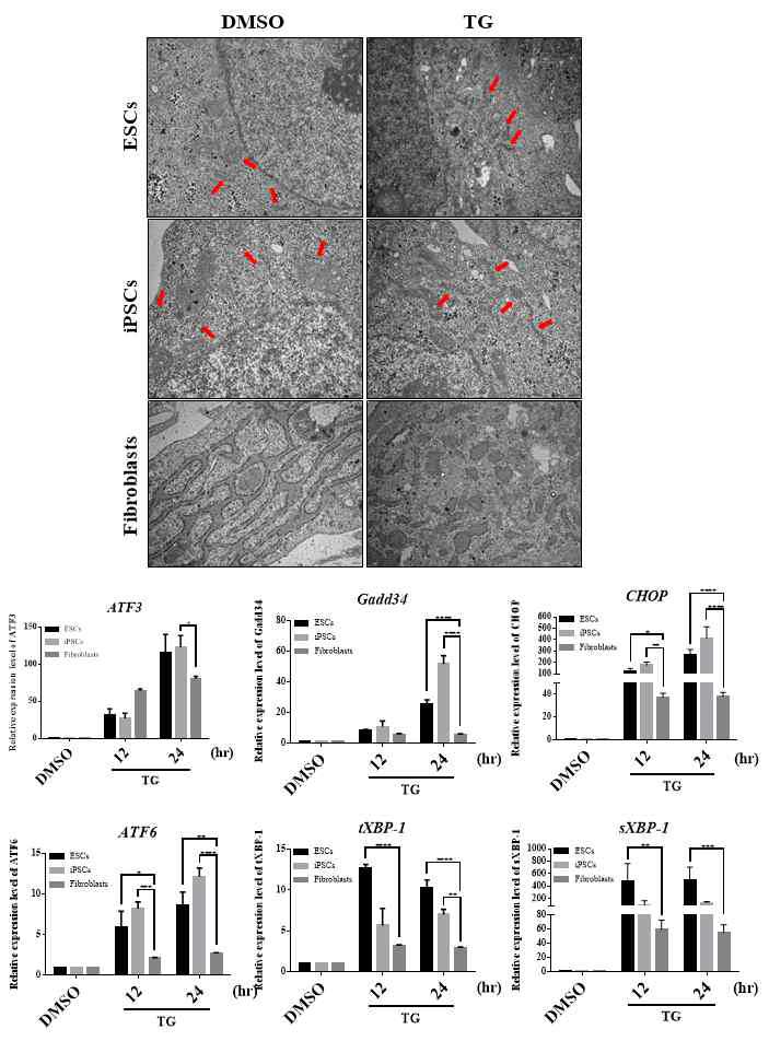 전분화능 줄기세포(hESC-H9, hiPSC-CMC3)와 체세포(MRC5)에 TG 처리에 의한 ER-stress 확인 (형태학적 특징-TEM, RT-PCR)