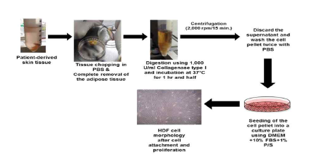 인체 유래 피부 섬유아세포 분리