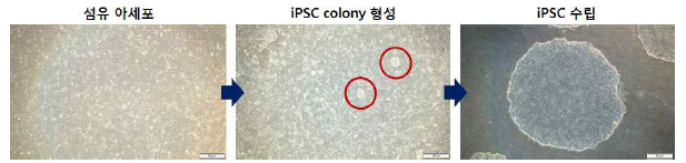 섬유아세포 및 췌도세포에서 유도만능줄기세포 유도 과정