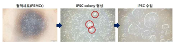 혈액세포(PBMCs)의 유도만능줄기세포 유도 과정