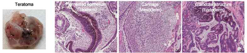 생체내 형성된 teratoma의 조직학적 형태
