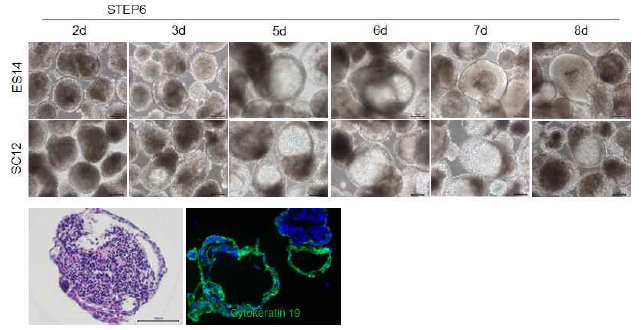 분화과정에서 형성되는 cyst formation