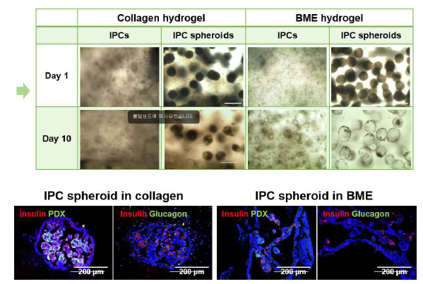 인슐린 생성세포/3차원 스페로이드를 수화젤에 봉입 후 형태 변화 및 인슈린/글루카곤 발현 확인
