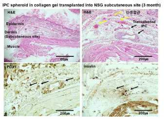 콜라겐 수화젤에 봉입된 인슐린 생성세포 의 피하 이식 후 조직학적 평가 (HE, Insulin, PDX1 염색)