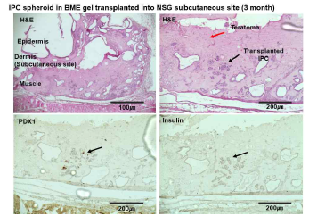 BME 수화젤에 봉입된 인슐린 생성세포 의 피하 이식 후 조직학적 평가 (HE, Insulin, PDX1 염색)