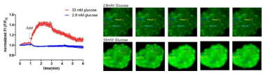 인체 췌도세포에서의 글쿠코즈 농도에 의한 칼슘 이미징