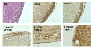이식 1개월 후 이식부위 조직학적 평가 (위), 이식 1, 2, 3개월 후 이식 부위 PDX1 을 발현하는 세포 확인 (아래)