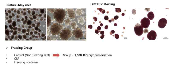 인체 췌도 세포의 구조 및 인슐린 분비 기능성 확인