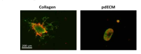 유도만능줄기세포 유래의 인슐린 분비 세포의 봉입 배양 실험 결과 (Green:live, Red:dead)