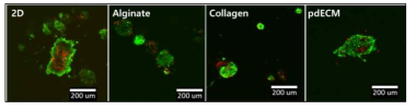 Human으로부터 분리한 췌도 세포를 이용하여 2D, alginate, collagen, pdECM 환경에서 5일간 배양한 후 Live/dead assay 염색