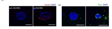 혈관 세포와의 공배양에 따른 islet의 인슐린 및 PDX1 발현 분석 결과