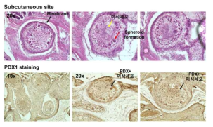 나노섬유-microwell을 활용한 췌장 오가놈의 피하 이식 결과