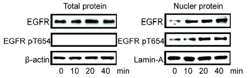 방사선 조사에 따른 EGFR 활성화 및 핵 내부 운송량 비교