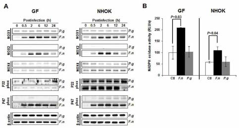 Human gingival fibroblasts (GFs)내 NOX1, NOX2, P47phox 발현 및 NADPH oxidase 활성은 감염되는 구강미 생물 균종에 따라 차등 발현 F .n.； F . nuclcatum，P .gl P . gingivalis