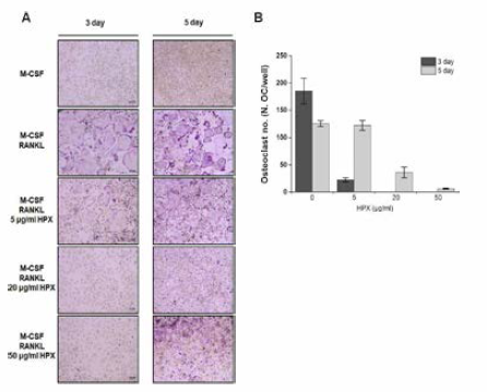 파골세포 분화시 HPX 처리에 따른 다핵형 파골세포 형성에의 영향