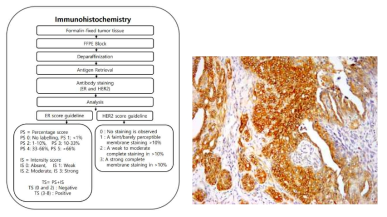 Immunohistochemistry 실험 Flow-chart(좌), ER/HER2 IHC 실험 사진(우)
