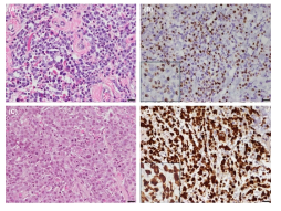 Canine cutaneous mast cell tumor의 H&E 사진 및 RNA-ISH 실험 결과
