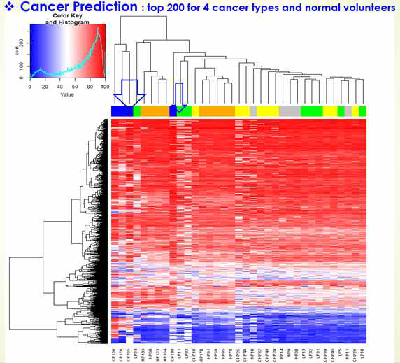 대장암종 환자혈장 4개 (청색), 간세포암종 환자 혈장 9개 (주황색), 폐암 환자 혈장 8개 (녹색), 만성 간염환자 혈장 9개 (노란색), 정상인 혈장 5개 (회색)의 cfDNA에 대해서 1000개마커 패널의 Methyl-Seq을 시행하였고 그 Beta value값에 의거하여 clustering을 하였음. 파란색 화살표로 표시한 것