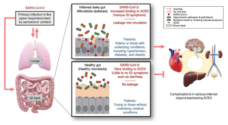 COVID-19이 extra-pulmonary complication을 일으키는 기전의 모델