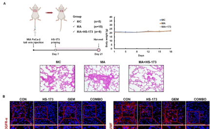 ANGPTL4에 의한 암 전이를 억제하는 HS-173과 gemcitabine 병용 투여 효능