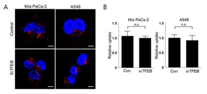 암세포주에서 TFEB knockdown이 macropinocytosis에 미치는 영향