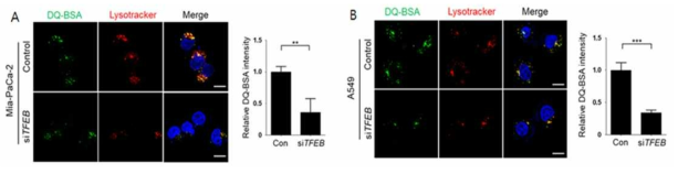 암세포주에서 TFEB knockdown이 lysosomal proteolysis에 미치는 영향