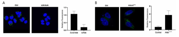 암세포주에서 Aldolase A 발현 조절이 lysosomal proteolysis에 미치는 영향