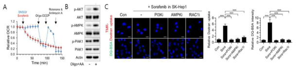 orafenib에 의해 인체 간암조직에서 macropinocytosis 가 증가함