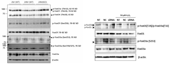 노화 마우스 심근에서 FoxOs 단백질의 변화 (좌:동물모델, 우:세포모델)