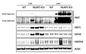 노화에 의한 NLRP3 inflammasome 활성화화 NNT 단백질의 발현 변화