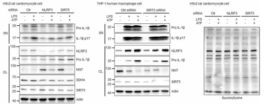 NLRP3 inflammasome 활성화에 따른 NNT 발현 변화 및 SIRT5에 의한 석시닐화 변화