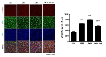 노화 마우스에서 NLRP3에 의한 myocyte hypertrophy 억제