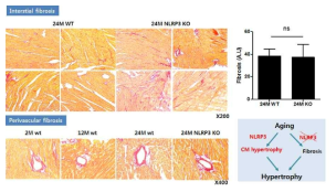 노화 마우스에서 fibrosis 변화 분석