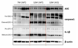 노화 마우스 심근에서 NLRP3 inflammasome에 의한 염증 반응 분석