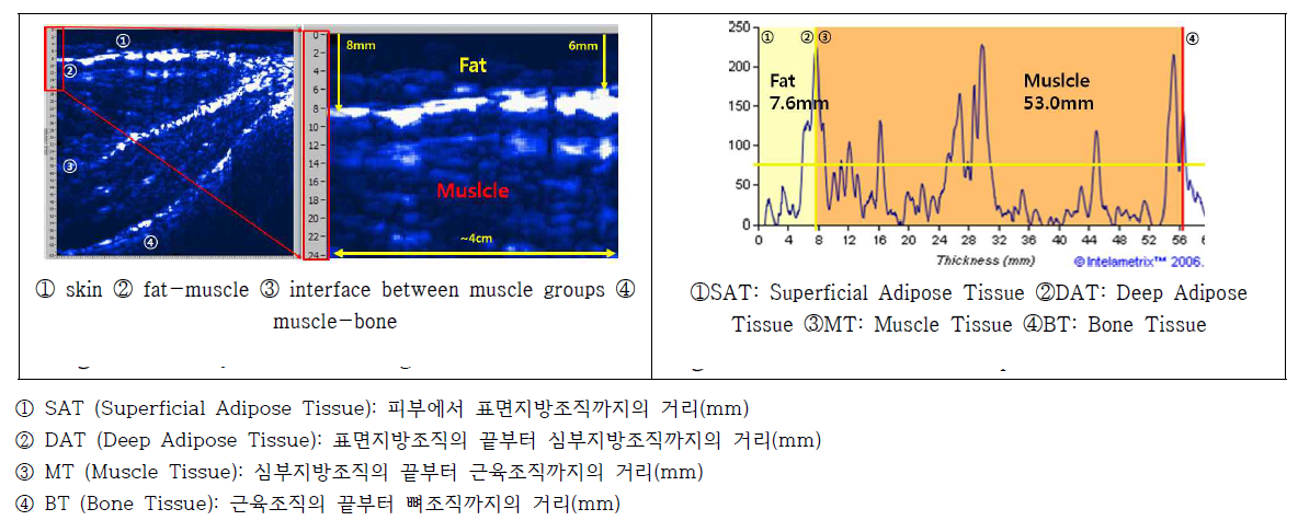 (왼쪽) Body view 2D image of BPS include (오른쪽) BPS record with parameters' definitions