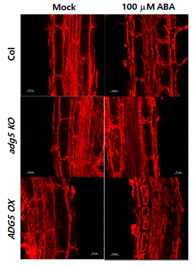 AGD5 변이체 primary root의 ABA에 의한 vacuole로의 물질이동의 변화. ABA 처리 조건에서 FM4-64 staining 후 endocytosis의 변화. Scale bar = 20 μm