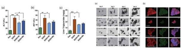 Roseburia spp. 복용한 알코올 지방간 마우스와 오가노이드에서 손상 감소 확인