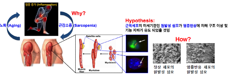 연구 개요도 근육세포의 원발성 섬모 연구를 통한 노인성 근감소증 병리기전의 이해