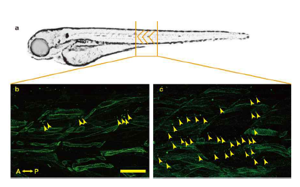 염증 유도 제브라피쉬의 근육세포에서의 원발성 섬모 이상 및 골격근 구조 이상을 관찰함