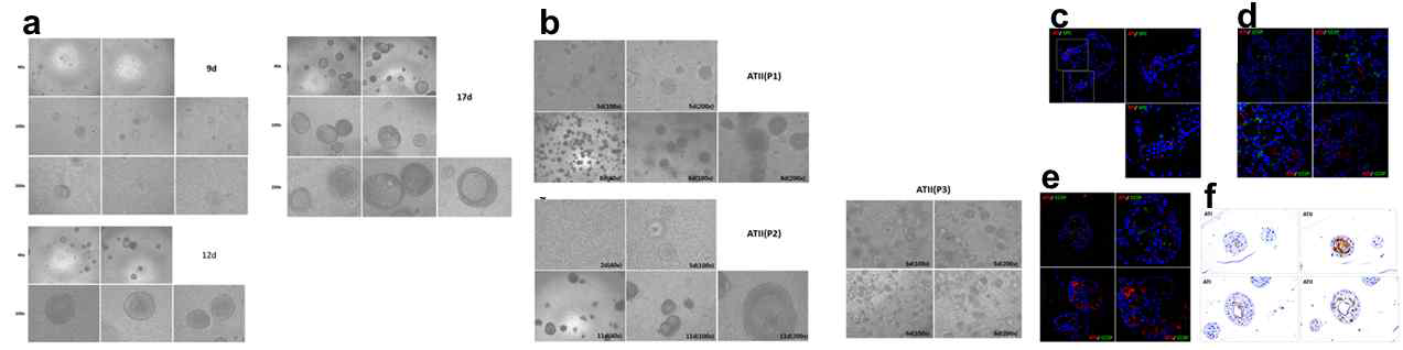 인체 폐 유래 세포를 이용한 오가노이드 제작 및 배양 (a-b) 2형 폐포 세포(P0-P3)와 섬유아세포를 공기 노출 배양하여 폐 오가노이드 제작 (c-f) 폐 오가노이드에서 폐포 세포 특이적 마커 확인