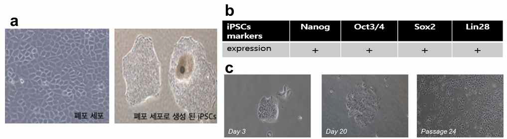 인체 폐 유래 세포 기반 iPSC 제작 (a) 폐포세포로의 iPSCs 생성법 확립 (b) iPSCs의 유전인자들에 대한 발현 (c) iPSCs의 계대배양