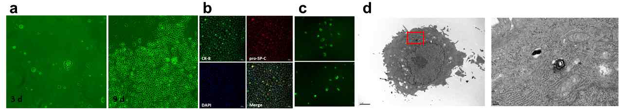 2형 폐포세포의 분리 배양 및 평가 (a) 세포 계대 배양 (b) pro-SP-C 면역 염색 (c) LysoTracker green DND-26 염색 (d) TEM을 이용한 lamellar body 관찰