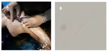 화이트팁상어 정자 샘플링. A: 수컷 화이트팁상어의 urogenital papilla 에서 정액 샘플링. B: 해수에 희석된 화이트팁상어 정자 (400X, optical microscope)