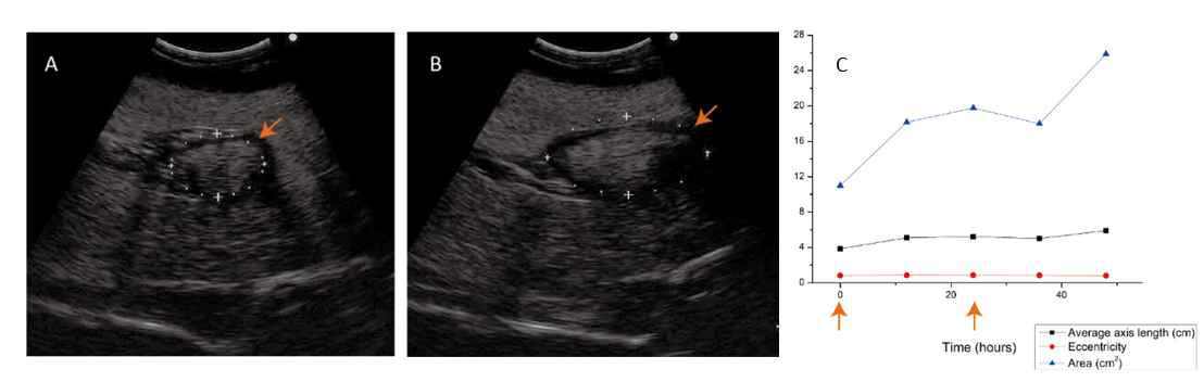 화이트팁상어 암컷에서 OvaprimⓇ 투여 전/후 난포 크기 변화. A: OvaprimⓇ 투여 전 초음파, 난포 크기 4.4 cm × 3.0 cm (10.27 cm2); B: OvaprimⓇ 투여 24시간 후 초음파, 난포 크기 7.4 cm × 3.7 cm (21.77 cm2); C: 난포의 장축, 이심률, 단면적 평균값 변화 그래프, 주황색 화살표가 투여 시점임